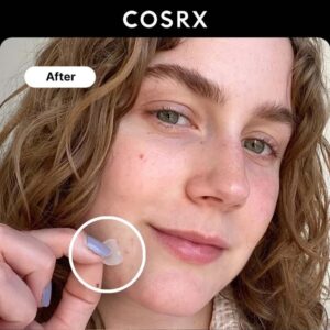 Acne Pimple Master Patch - Image 2
