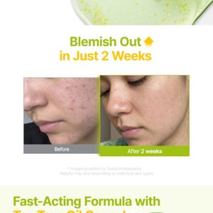 Azelaic Acid 10 Kojic Tea Tree Serum - Image 4