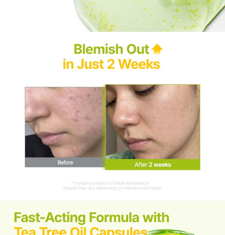 Azelaic Acid 10 Kojic Tea Tree Serum