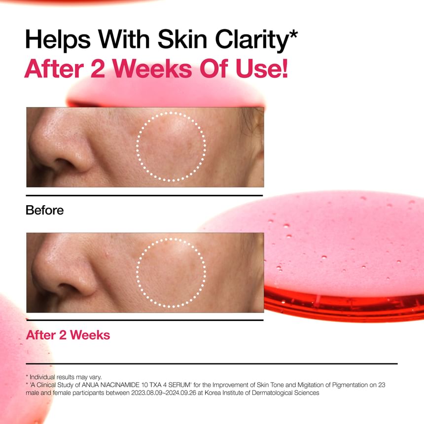 Niacinamide 10 TXA 4 Serum